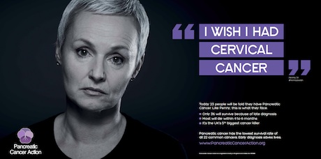pancreatic-cancer-2014-460