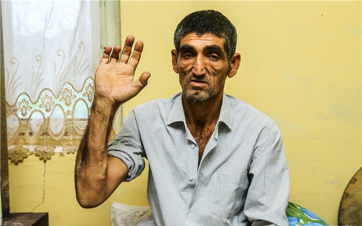 İstanbulda "Demokratiya və Şəhidlər" mitinqi başladı - fotolar