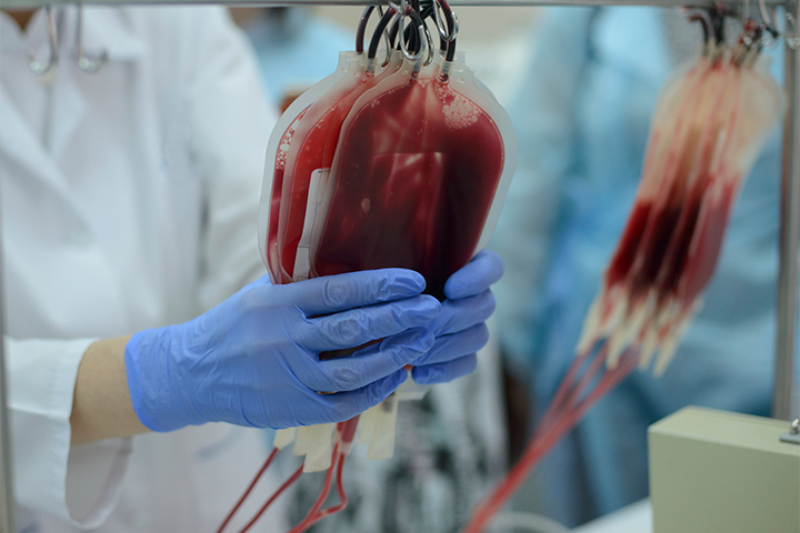 Azərbaycanda immun plazması ilə sağalan koronavirus xəstələrinin sayı açıqlandı