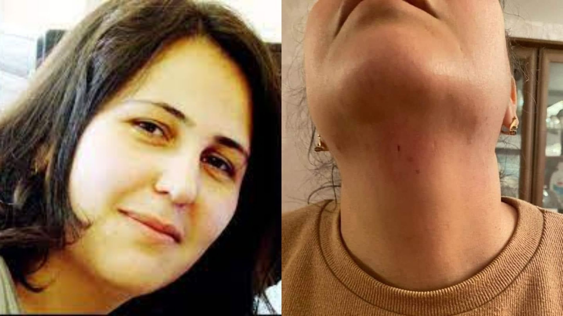 Polis jurnalist Aytən Məmmədovaya istintaqın dayanmadığını bildirib