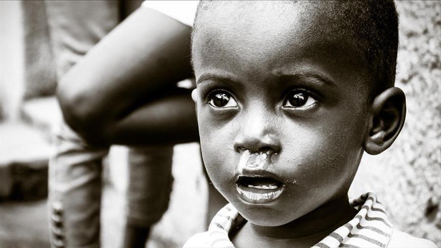 Konqoda "Ebola" virusundan 200-dək insan ölüb