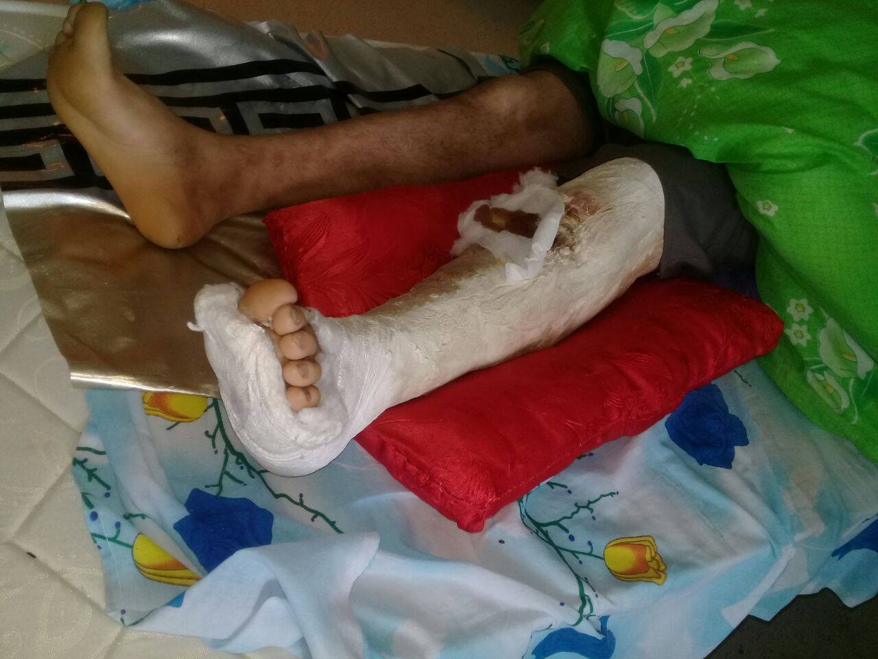 "Həkimlərin və müdirin laqeydsizliyindən fəhlə əmimin ayağı kəsilə bilər"