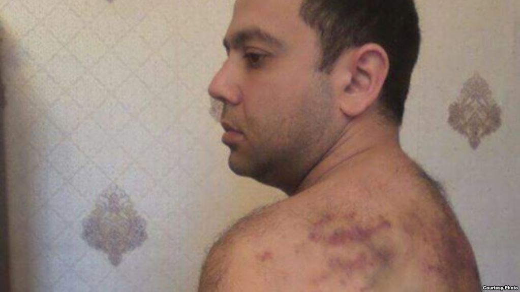 Jurnalist İlqar Vəliyev: "Döyürdülər, erməni casusu olduğumu etiraf etməyimi tələb edirdilər" [foto]