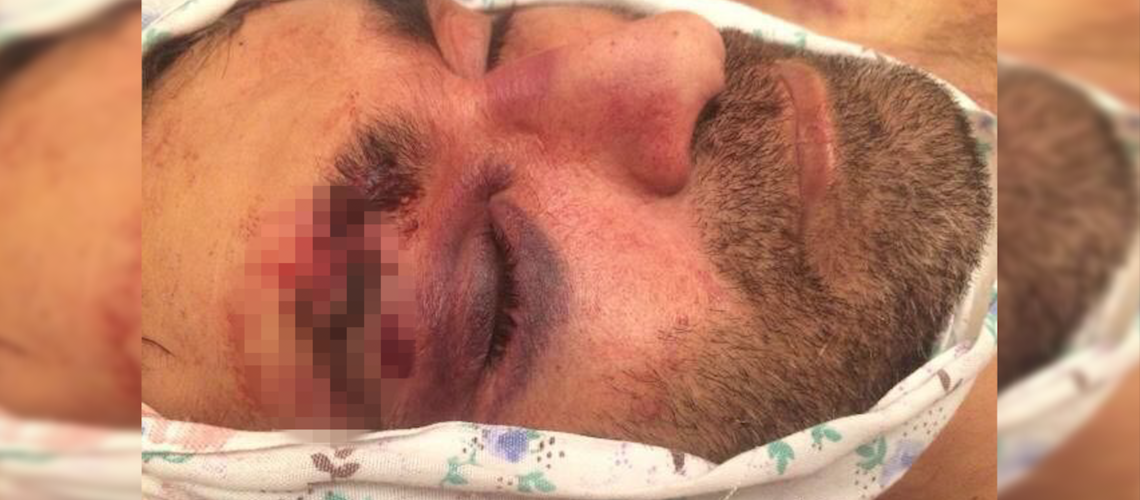 Qazaxda polis idarəsinə izahat alınması üçün çağırılan şəxs ölüb- VIDEO