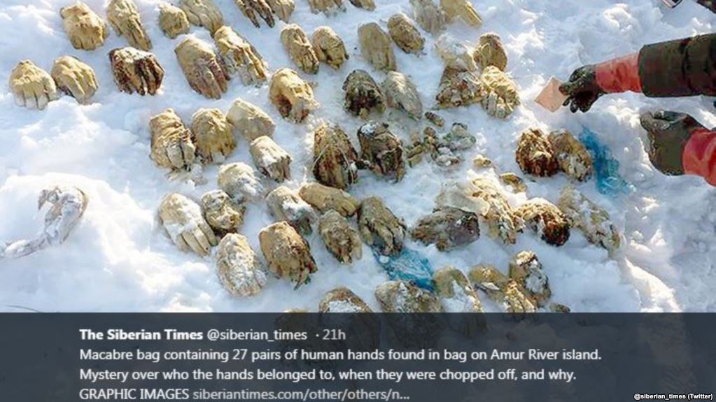 Rusiyada tapılmış "bir çanta əl" müəmması