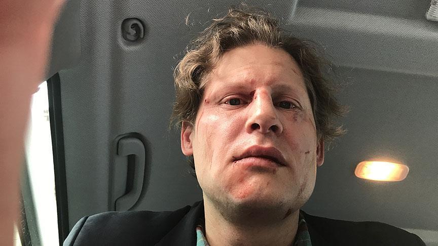 Almaniyada jurnalist PKK tərəfdarları tərəfindən döyülüb