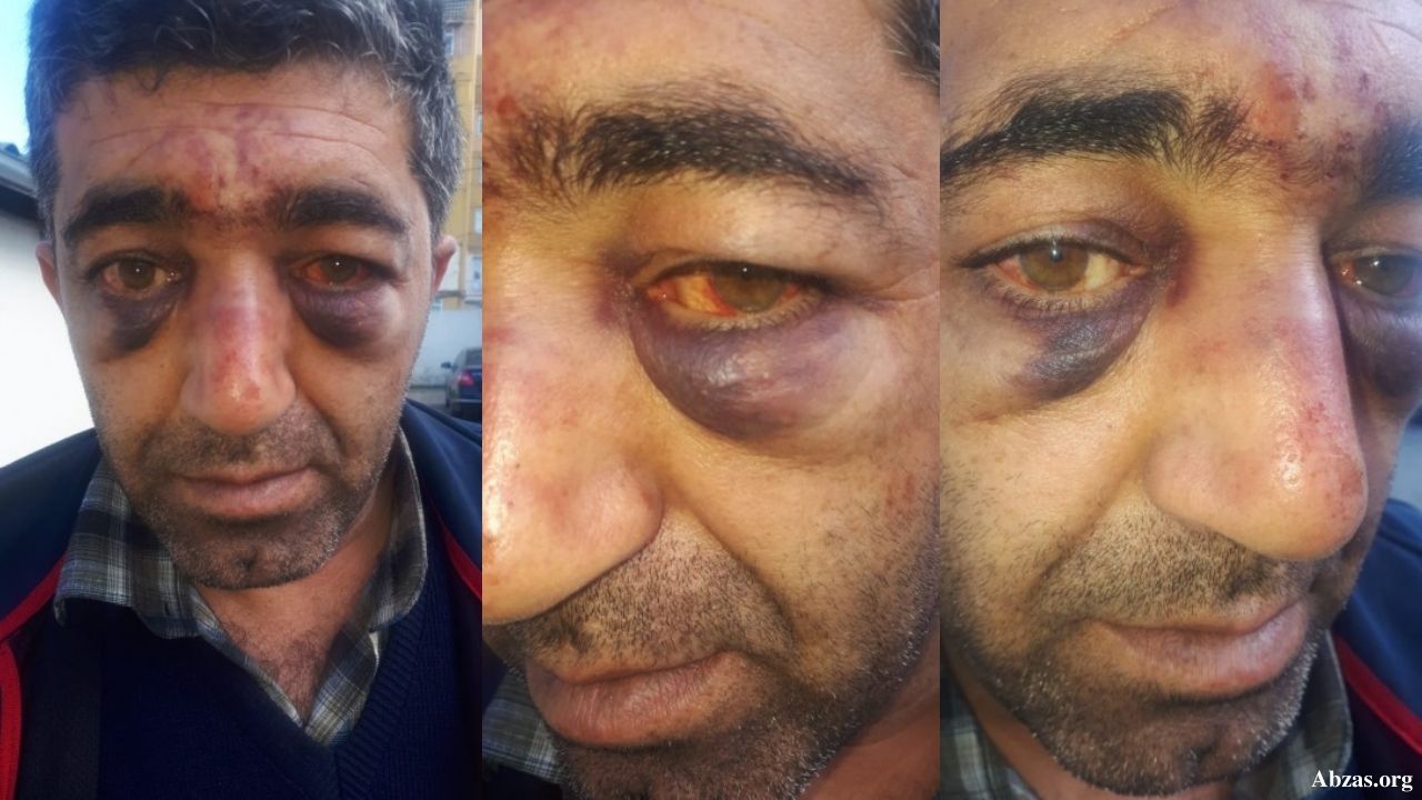 "Oğlum polislər tərəfindən vəhşicəsinə döyülüb"