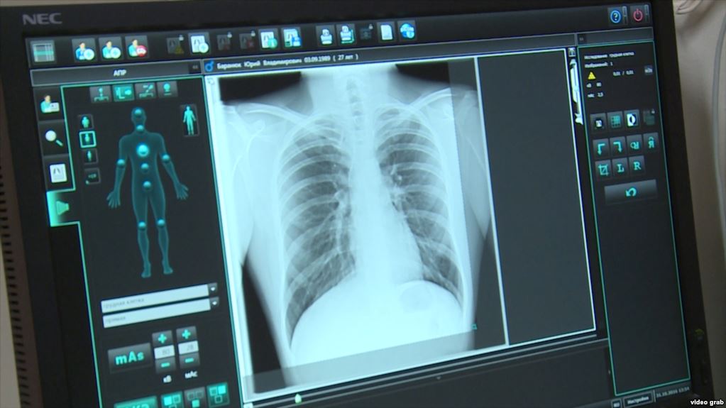 “8 yaşlı oğlum həkimlərin əlində öldü”