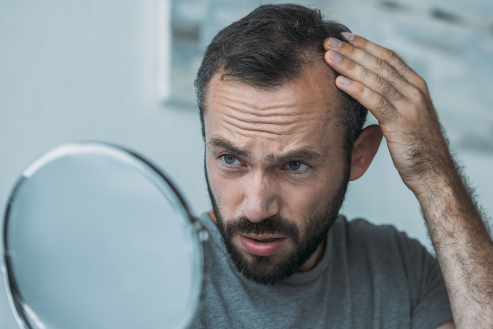 Nicht jede/r ist mit voller Haarpracht gesegnet | Credit: LightFieldStudios/iStock.com