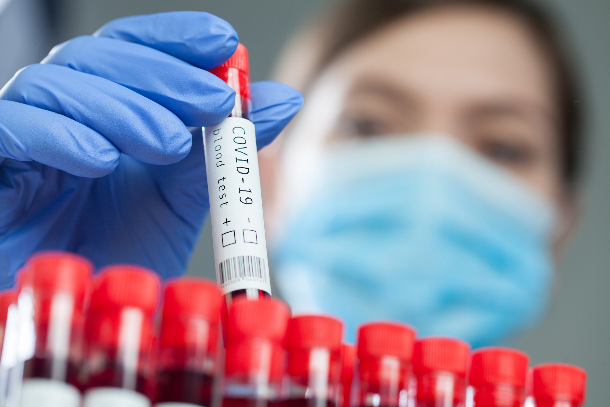 PCR-Gurgeltest