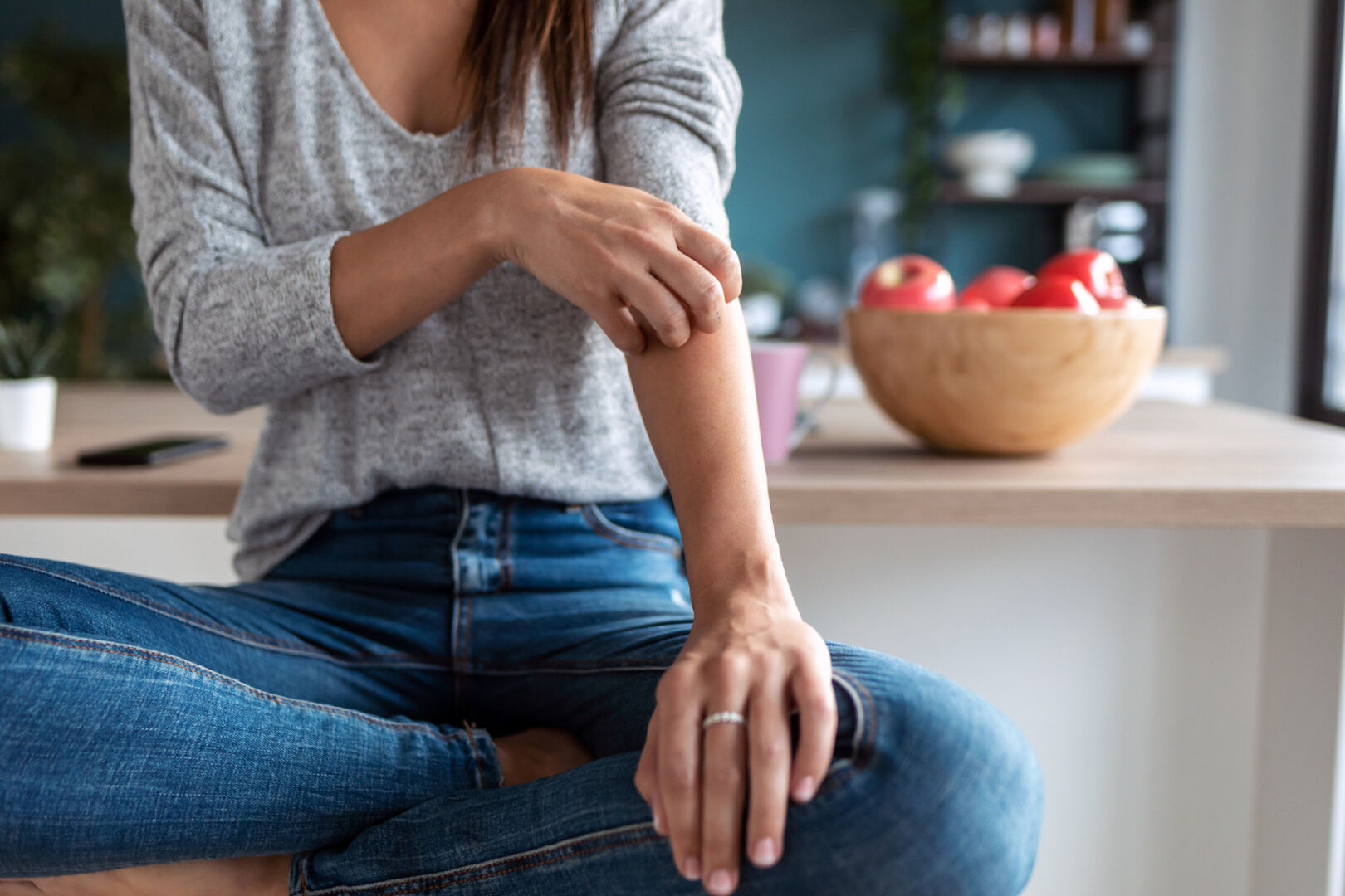 Frau kratzt sich am Arm | Credit: iStock.com/nensuria