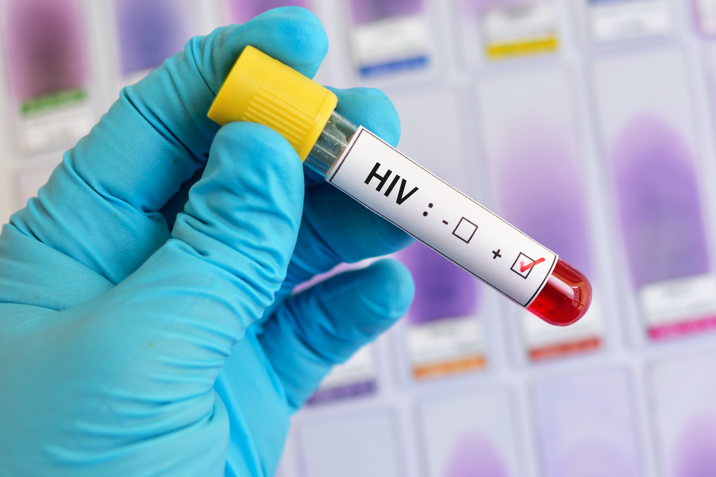 Bluttest HIV