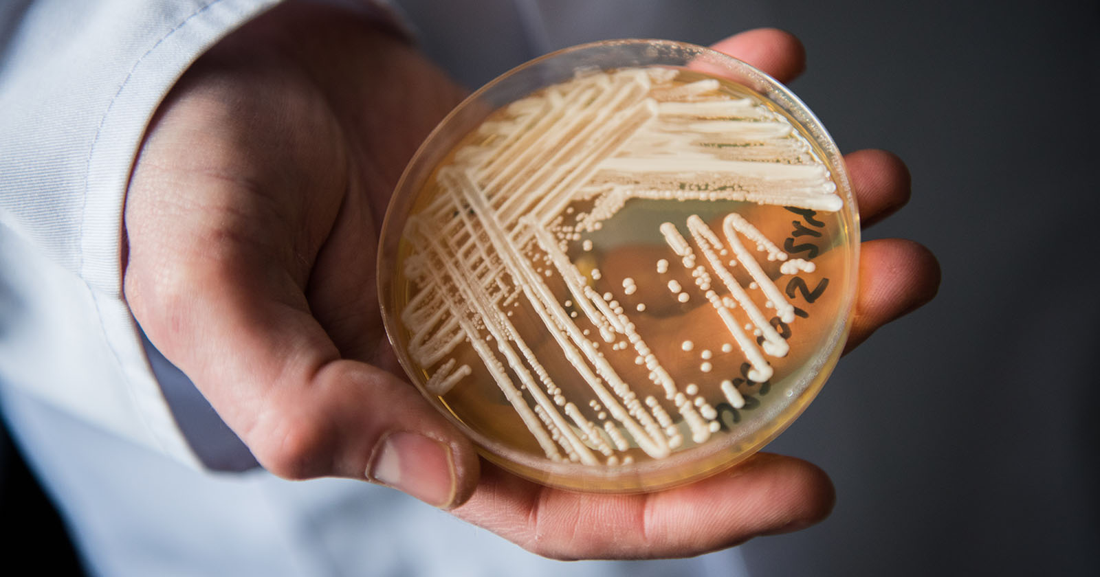 Der Hefepilz "Candida Auris" in einer Petrischale im Labor