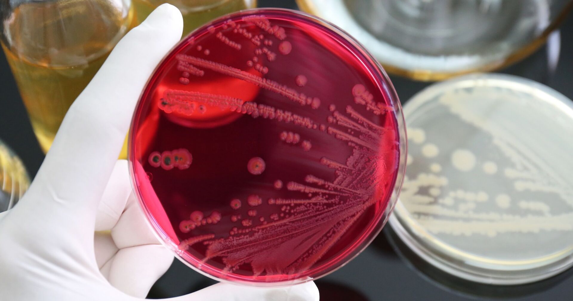 Salmonellen im Labor.