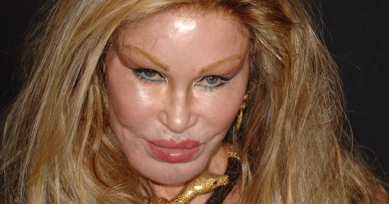 Ihr durch Schönheitsoperationen entstandenes Aussehen hat Jocelyn Wildenstein den Spitznamen "Catwoman" eingebracht.
