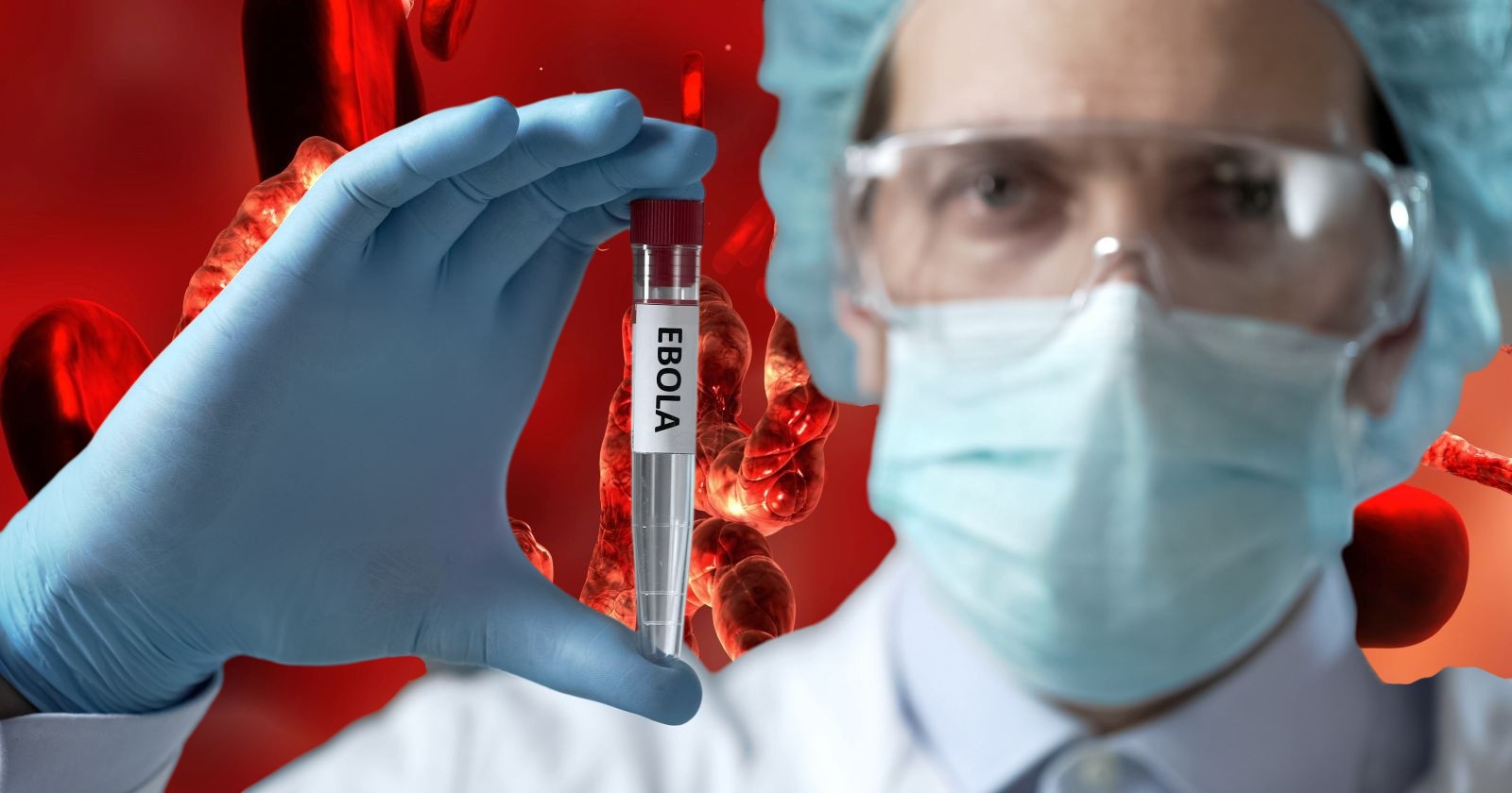 Ebola-Ausbruch Kongo: Arzt untersucht Blutprobe im Labor, WHO warnt vor internationaler Ausbreitung