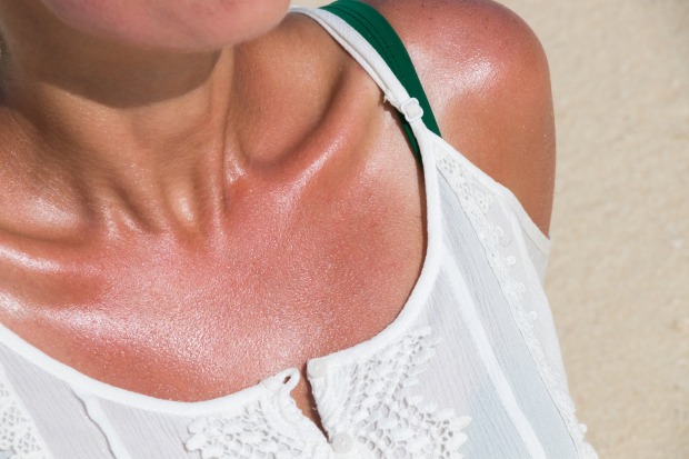 Dekolletee einer Frau mit leichtem Sonnenbrand