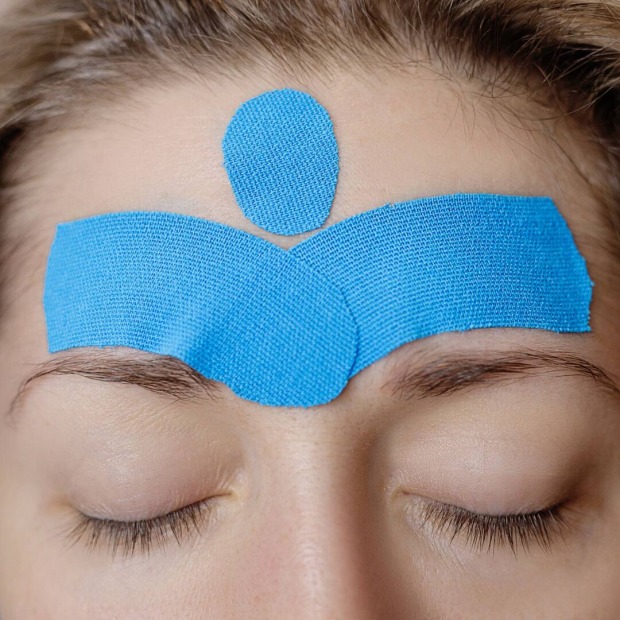 Junge Frau mit blauen Beauty Tapes auf der Stirn | Credit: iStock.com/Tatsiana Volkava