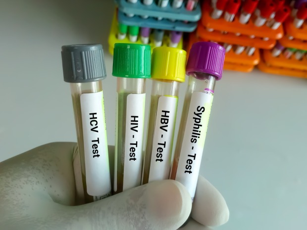 Verschiedene Tests für sexuell übertragbare Infektionen