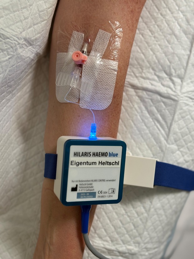 Medizinisches Laser-Gerät | Credit: Primärversorgungseinheit Wien Nord