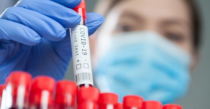 PCR-Gurgeltest