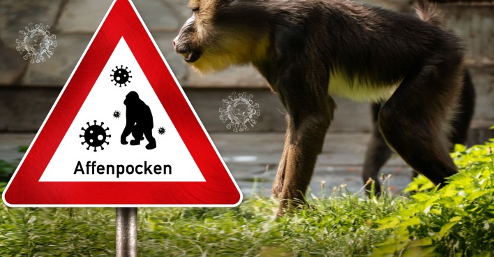 Affenpocken