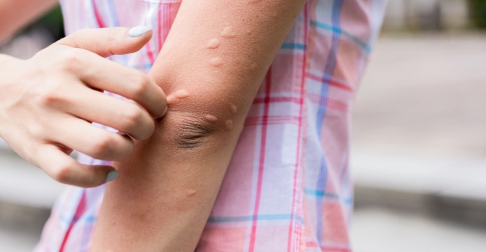 Kälteallergie | Credit: iStock.com/ RyanKing999