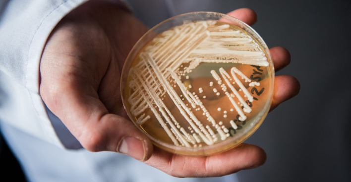Der Hefepilz "Candida Auris" in einer Petrischale im Labor