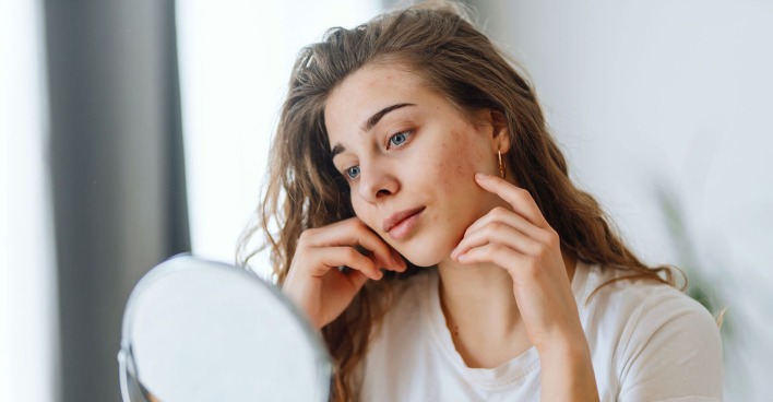 Frau schaut sich ihre Haut im Spiegel an | Credit: iStock.com/Maksym Belchenko