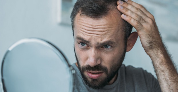 Nicht jede/r ist mit voller Haarpracht gesegnet | Credit: LightFieldStudios/iStock.com
