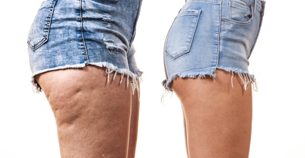 Mit diesen Tipps lässt sich das Hautbild verbessern. | Credit: iStock.com/Anetlanda