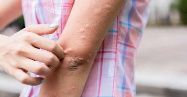Kälteallergie | Credit: iStock.com/ RyanKing999