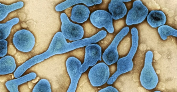 Das Virus wird durch Tigermücken übertragen.