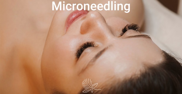 Frau nach einer erfolgreichen Microneedling-Behandlung | Credit: Individual Beauty