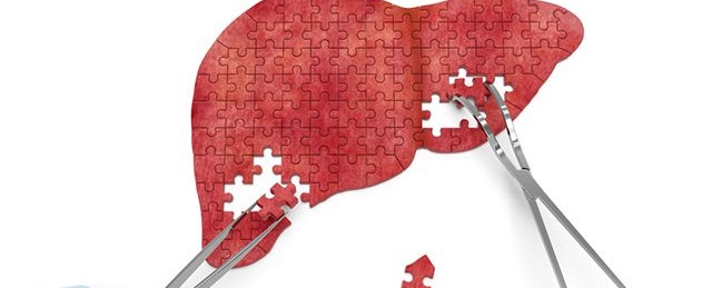 How much does liver transplant cost? BOOKIMED