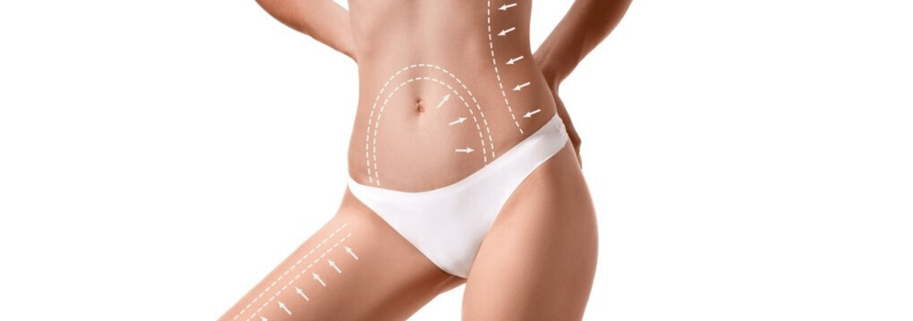 How Much Does A Liposuction Cost You Best Prices Around The World Bookimed