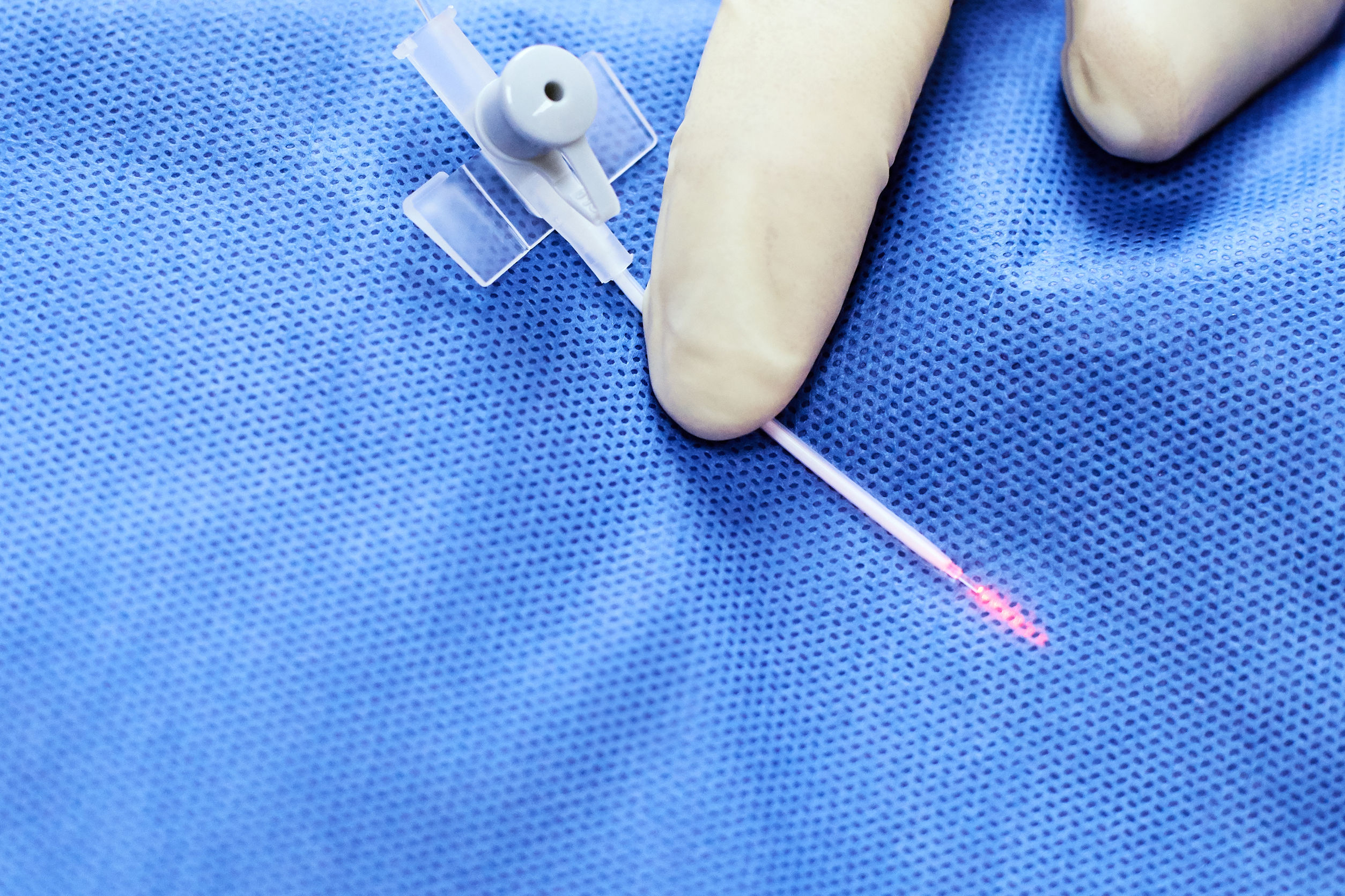 علاج الدوالي بالليزر في Vein Clinic Alanya و Dr. ZAN Vein Clinic Antalya