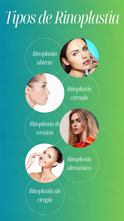tipos de rinoplastia