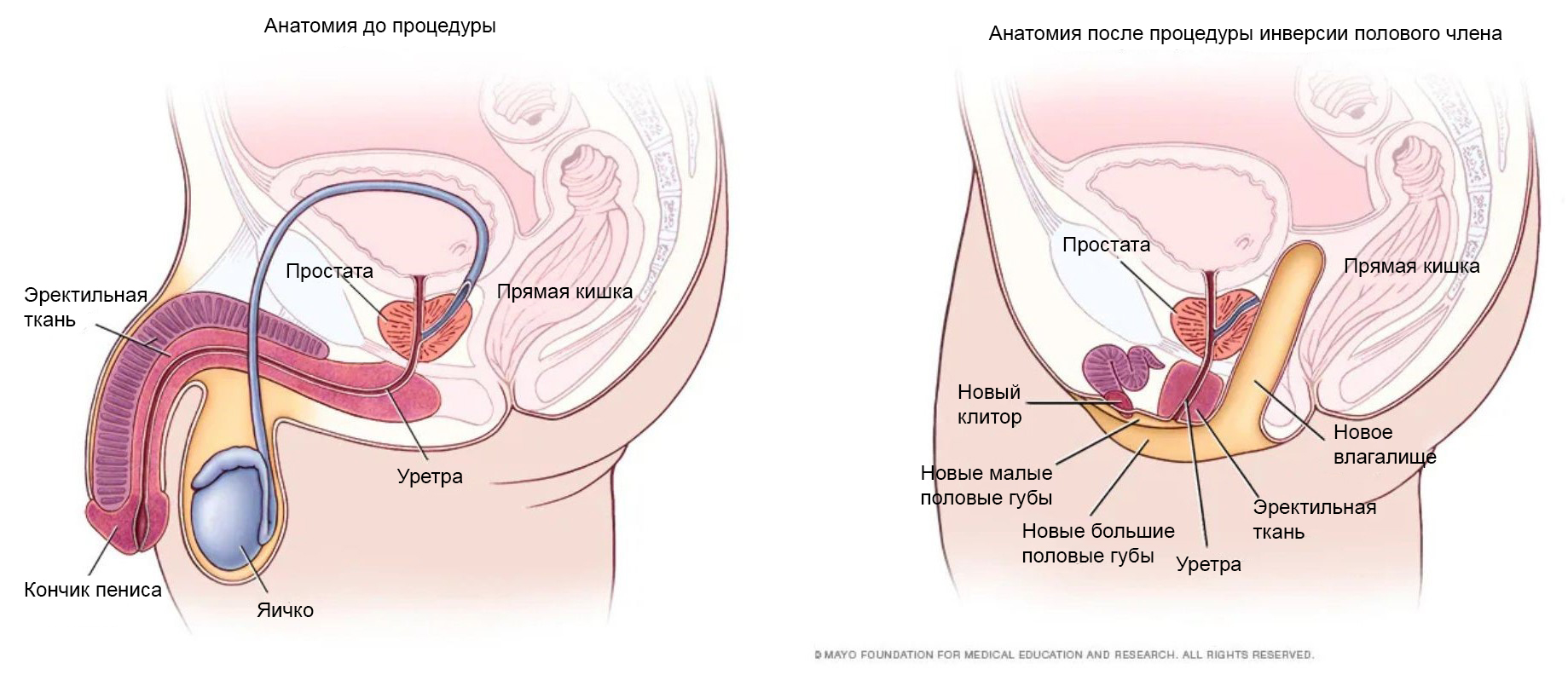Как выглядят половые органы после смены пола