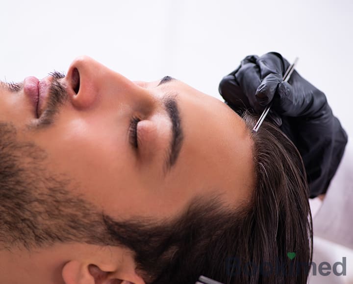 implan rambut meksiko