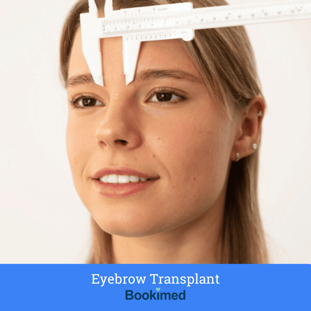 eyebrow transplant results with fue technique