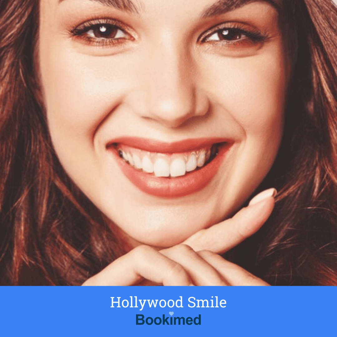 hollywood smile treatment - dental implants