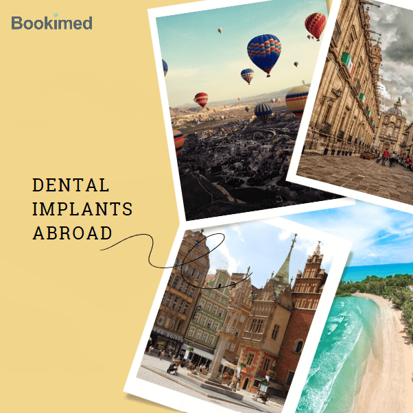 full mouth restoration affordable treatments with underlying implants
