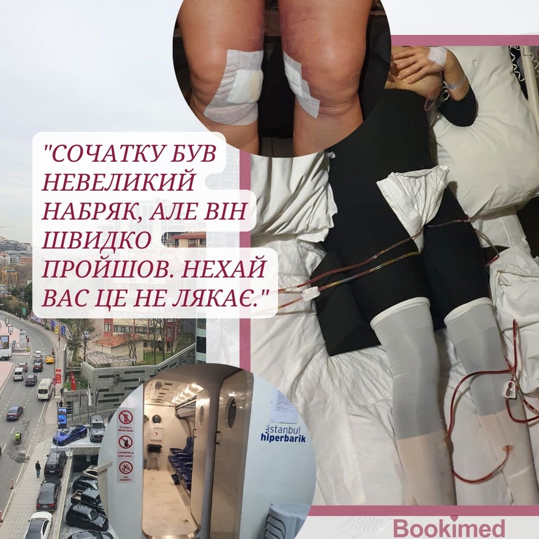 Відновлення та результати ліпосакції
