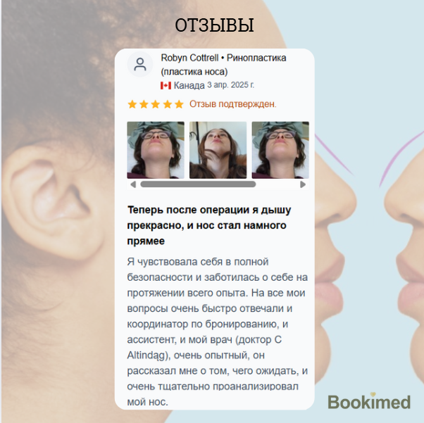 рино