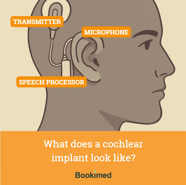cochlear nerve device