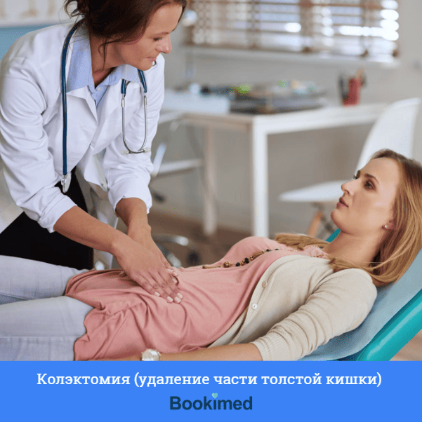 операциясубтотальной колэктомии