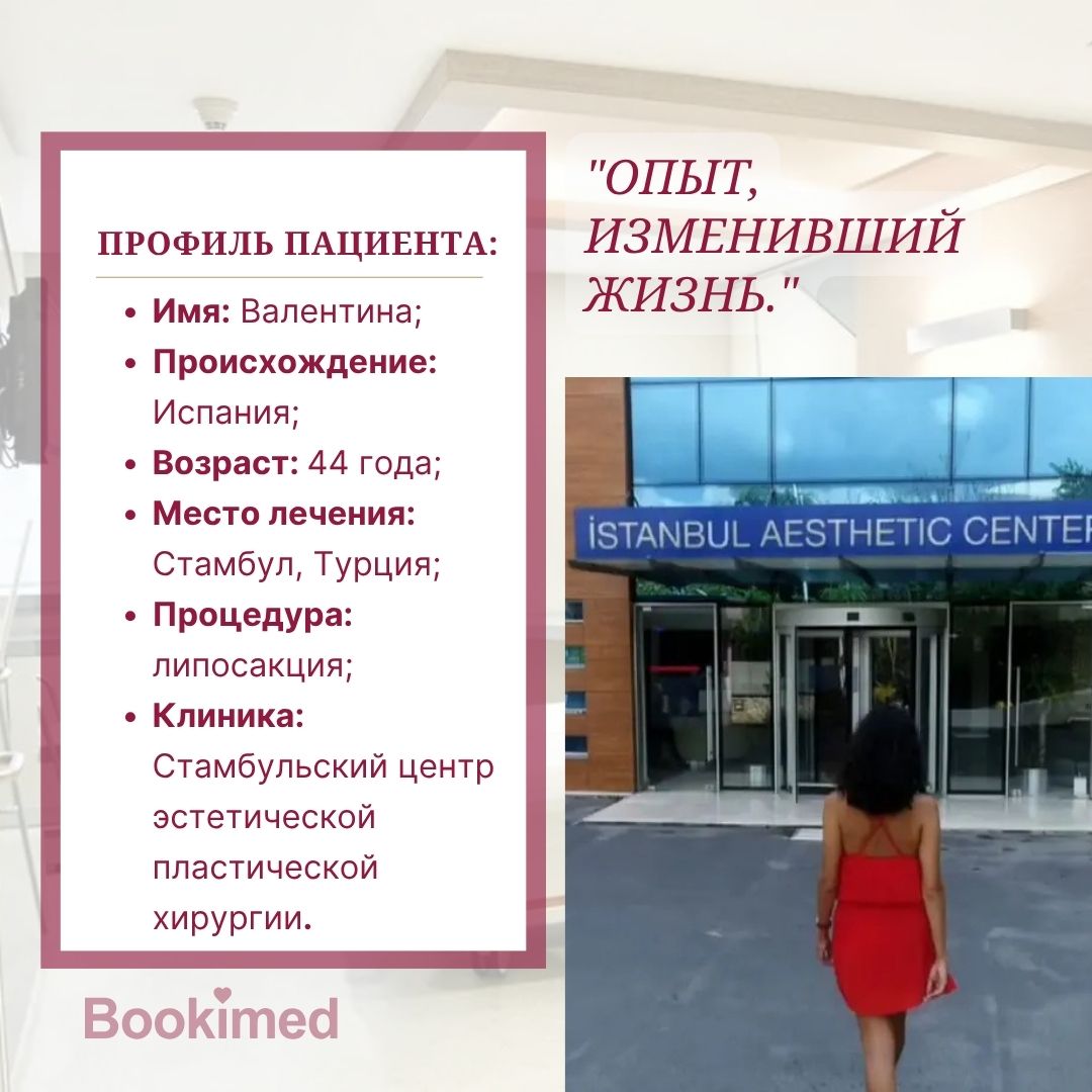 Операция и восстановление: опыт липосакции в Турции