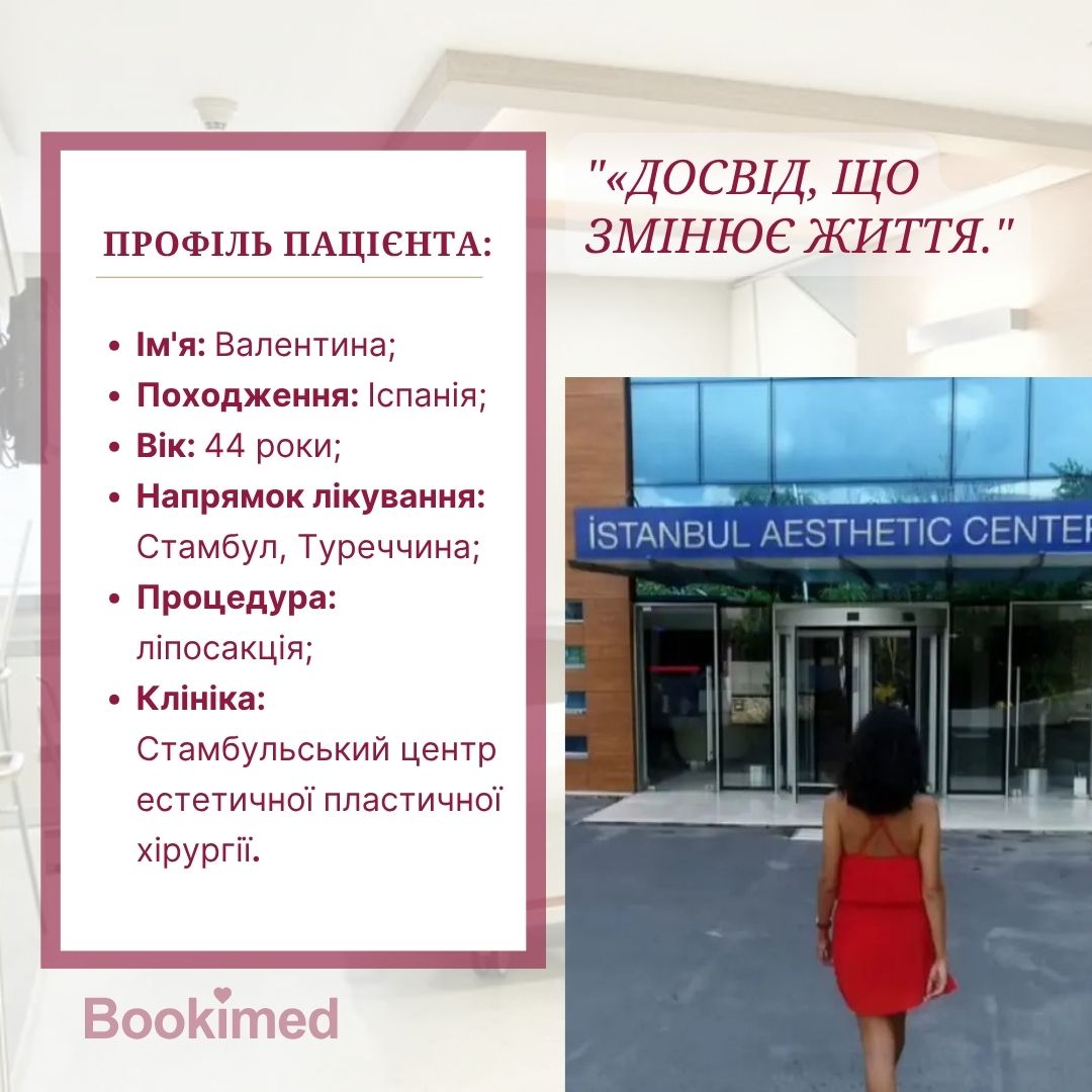 Операція та відновлення: досвід ліпосакції в Туреччині