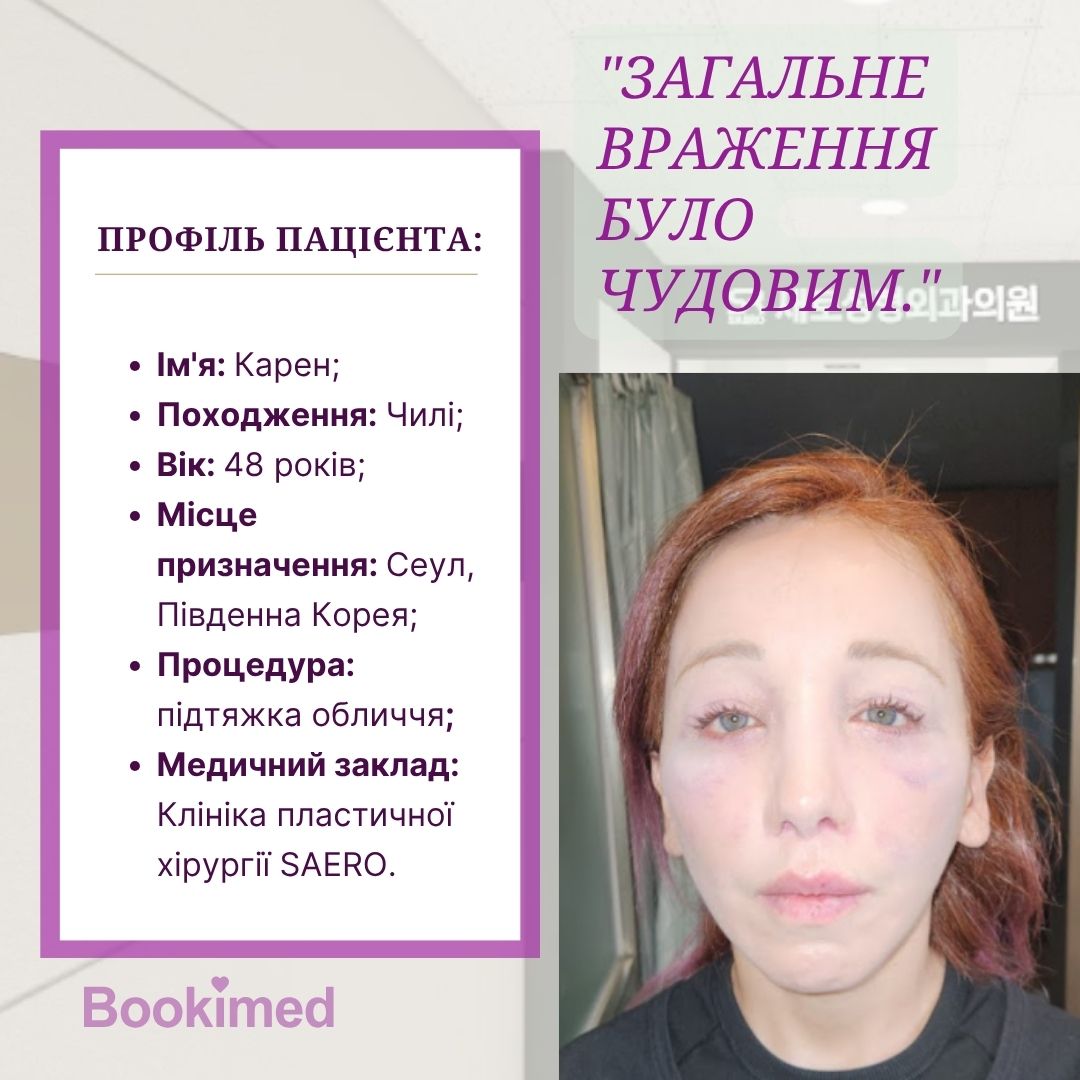 підтяжка обличча
